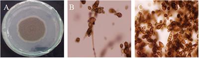 Impact of Transgenic Brassica napus Harboring the Antifungal Synthetic Chitinase (NiC) Gene on Rhizosphere Microbial Diversity and Enzyme Activities